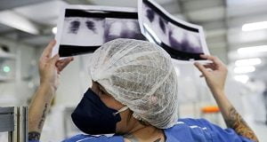 Primeiro paciente a receber rim de porco, morre dois meses após cirurgia