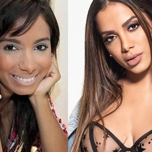 anitta-antes-e-depois