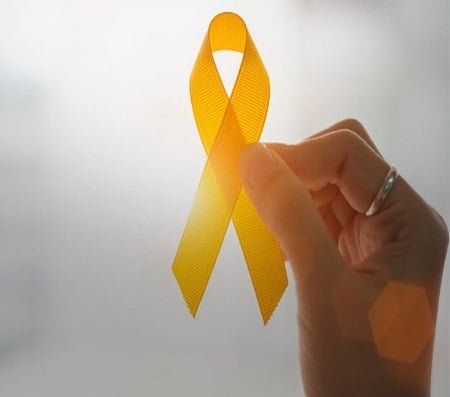 amarelo