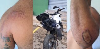 Médico posta story após atropelar motociclista na Paralela; preocupação com o carro chama atenção