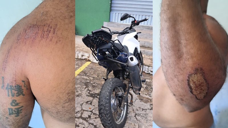 Médico posta story após atropelar motociclista na Paralela; preocupação com o carro chama atenção