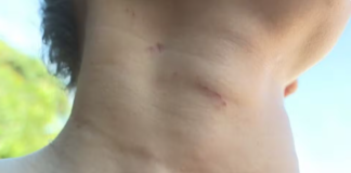 Jovem agredida por namorado pediu ajuda por app de mensagens; cárcere durou 10 dias